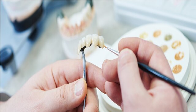 اعطای مجوز دانش‌بنیان برای ۶ محصول حوزه دندانپزشکی